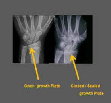 how to tell when you stop growing